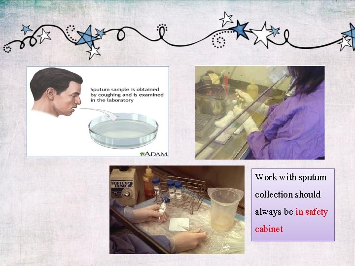 Work with sputum collection should always be in safety cabinet 