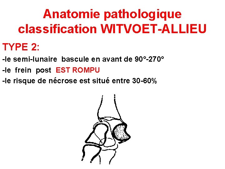 Anatomie pathologique classification WITVOET-ALLIEU TYPE 2: -le semi-lunaire bascule en avant de 90°-270° -le