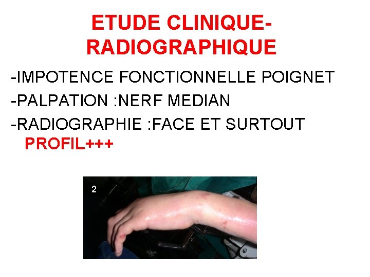 ETUDE CLINIQUERADIOGRAPHIQUE -IMPOTENCE FONCTIONNELLE POIGNET -PALPATION : NERF MEDIAN -RADIOGRAPHIE : FACE ET SURTOUT