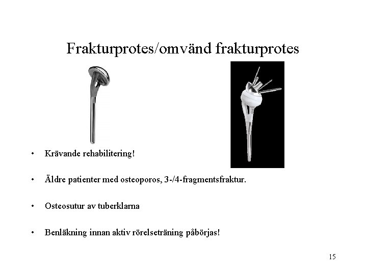 Frakturprotes/omvänd frakturprotes • Krävande rehabilitering! • Äldre patienter med osteoporos, 3 -/4 -fragmentsfraktur. •