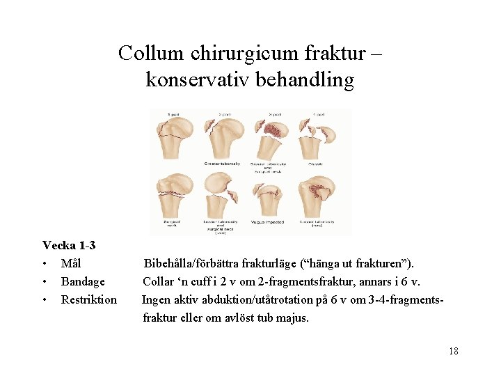 Collum chirurgicum fraktur – konservativ behandling Vecka 1 -3 • Mål • Bandage •