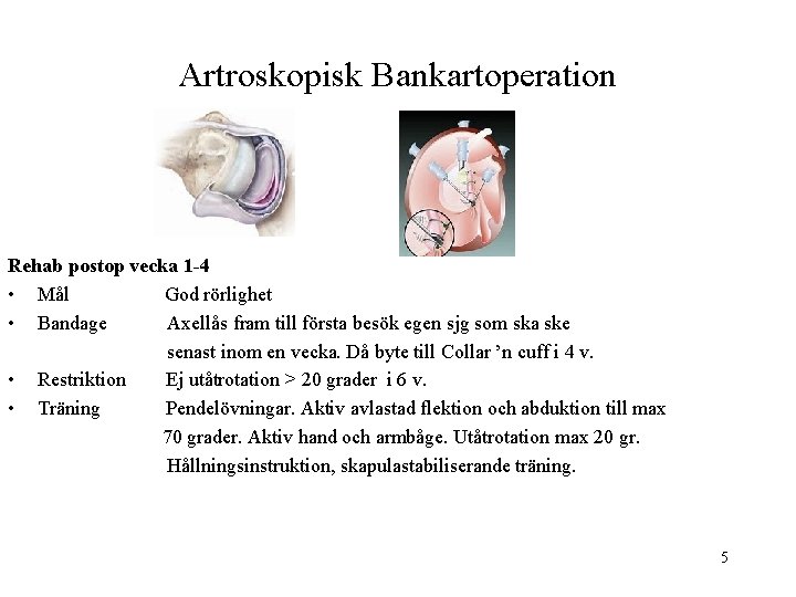 Artroskopisk Bankartoperation Rehab postop vecka 1 -4 • Mål God rörlighet • Bandage Axellås