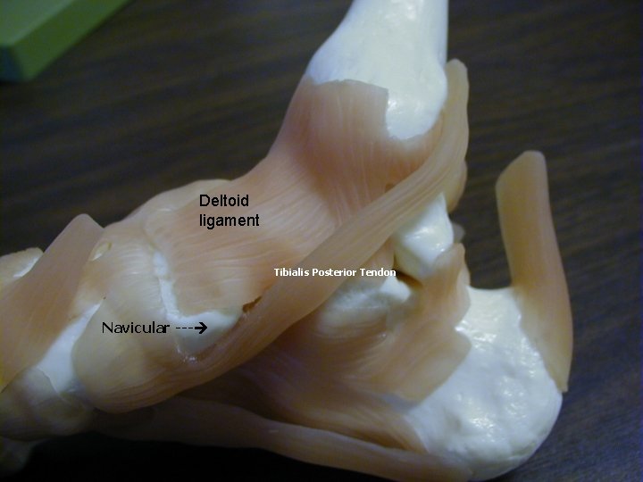 Deltoid ligament Tibialis Posterior Tendon Navicular --- 