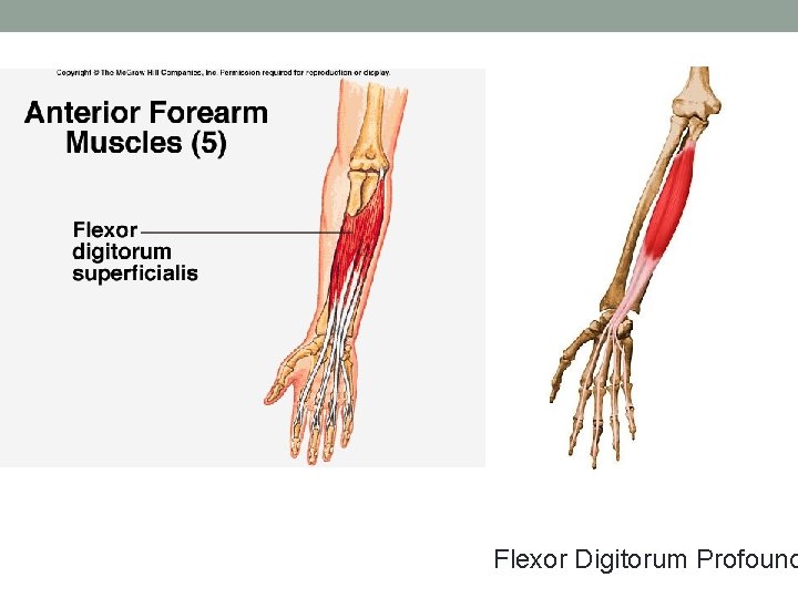 Flexor Digitorum Profound 