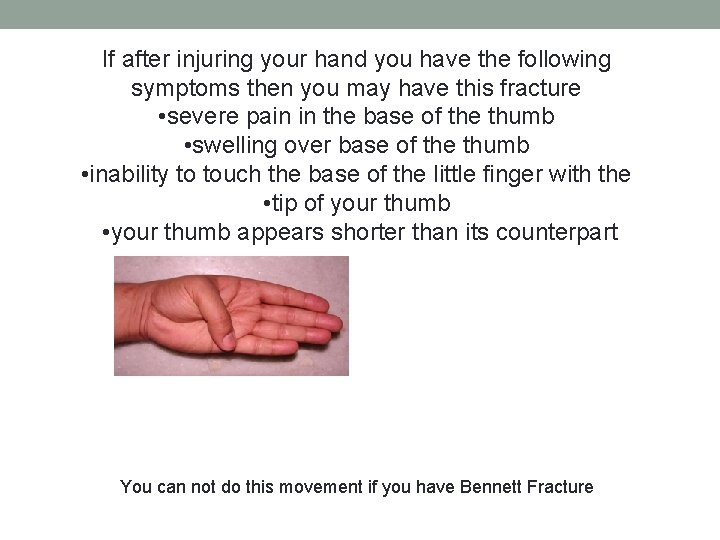 If after injuring your hand you have the following symptoms then you may have