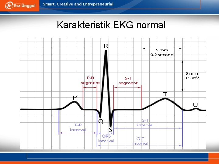 Karakteristik EKG normal 