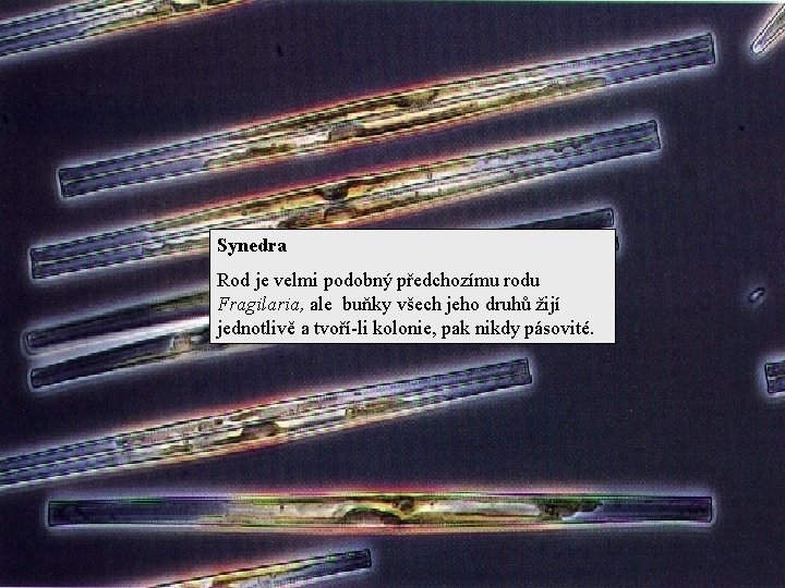 Synedra Rod je velmi podobný předchozímu rodu Fragilaria, ale buňky všech jeho druhů žijí