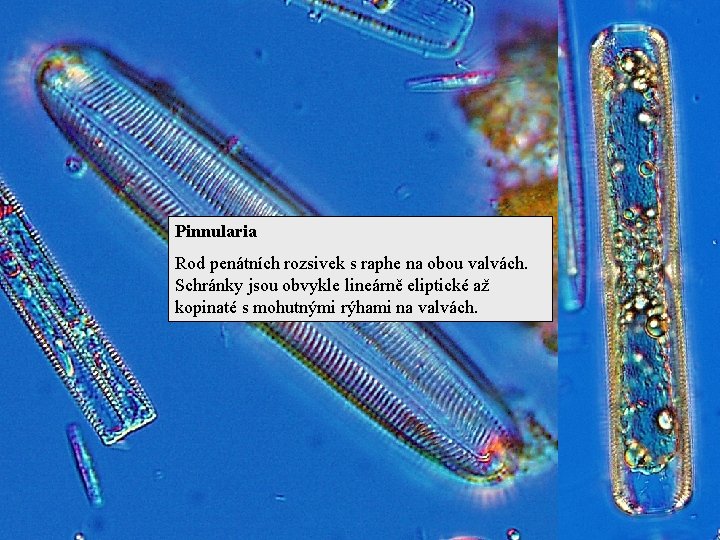Pinnularia Rod penátních rozsivek s raphe na obou valvách. Schránky jsou obvykle lineárně eliptické