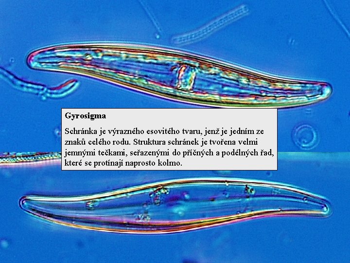 Gyrosigma Schránka je výrazného esovitého tvaru, jenž je jedním ze znaků celého rodu. Struktura