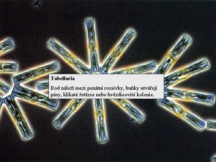 Tabellaria Rod náleží mezi penátní rozsivky, buňky utvářejí pásy, klikaté řetězce nebo hvězdicovité kolonie.