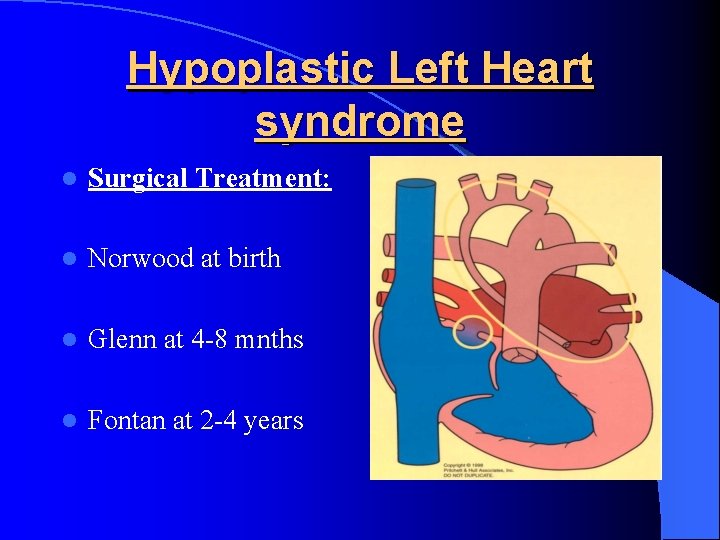 Hypoplastic Left Heart syndrome l Surgical Treatment: l Norwood at birth l Glenn at