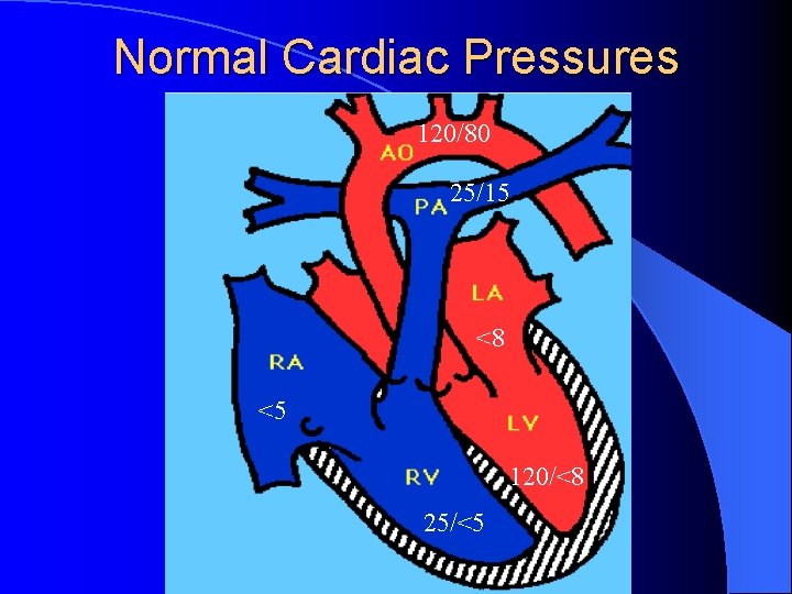 Normal Cardiac Pressures 120/80 25/15 <8 <5 120/<8 25/<5 