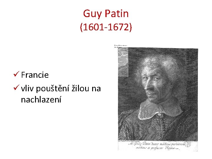 Guy Patin (1601 -1672) ü Francie ü vliv pouštění žilou na nachlazení 