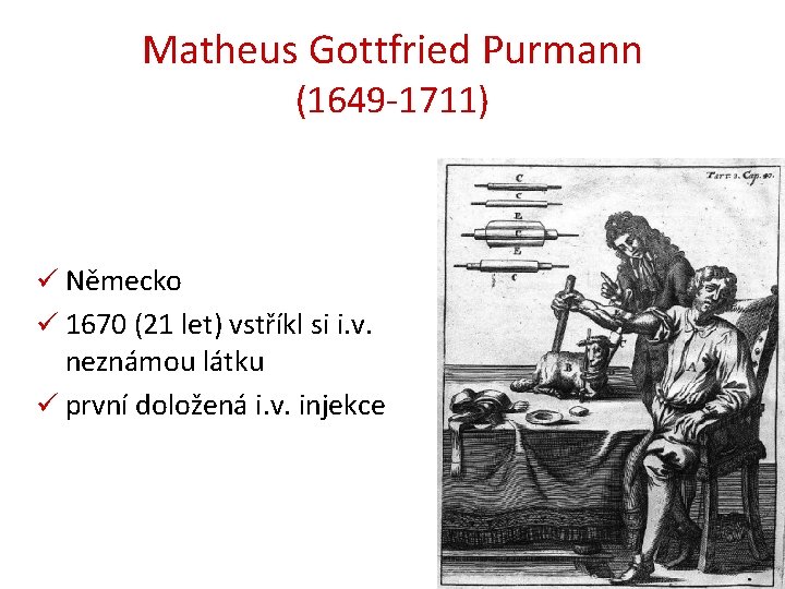 Matheus Gottfried Purmann (1649 -1711) ü Německo ü 1670 (21 let) vstříkl si i.