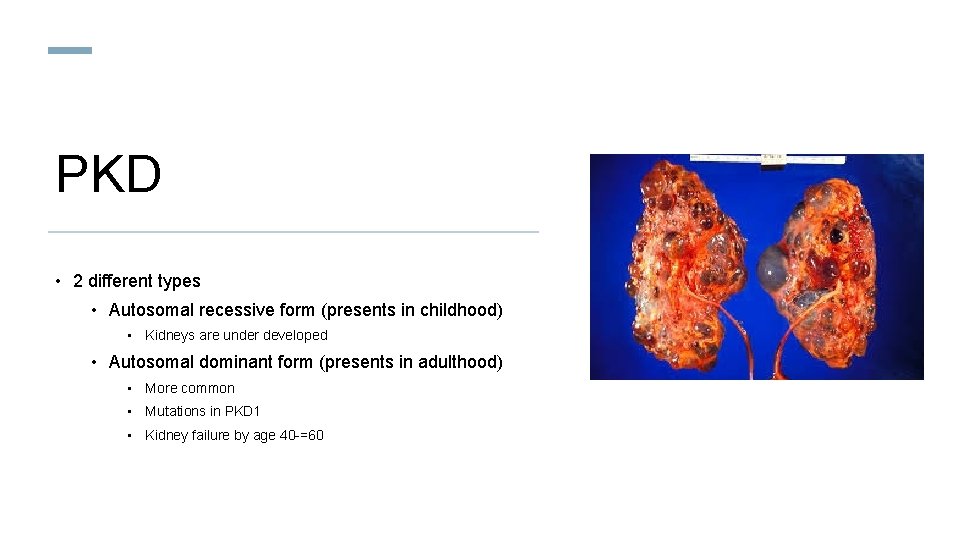 PKD • 2 different types • Autosomal recessive form (presents in childhood) • Kidneys