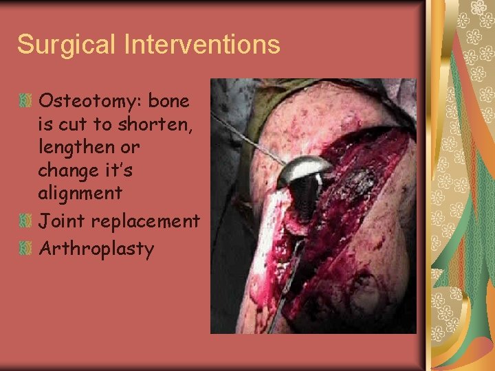Surgical Interventions Osteotomy: bone is cut to shorten, lengthen or change it’s alignment Joint