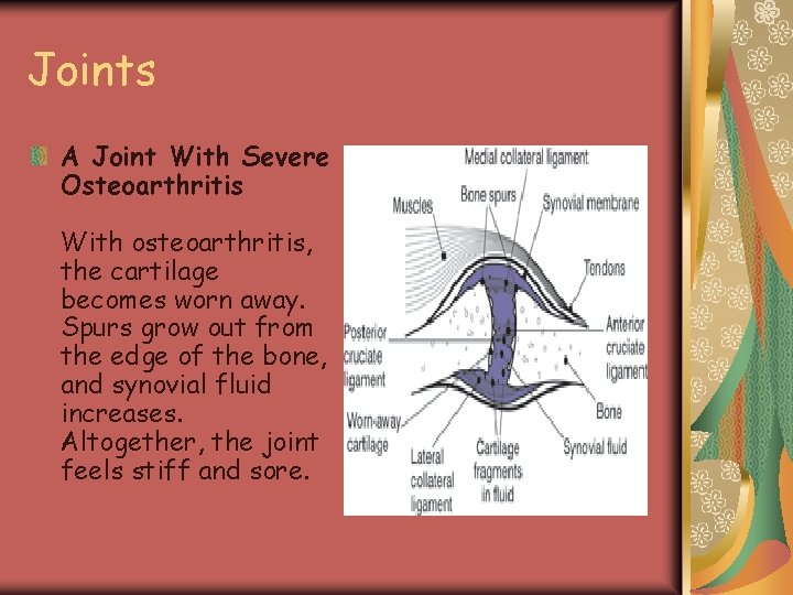 Joints A Joint With Severe Osteoarthritis With osteoarthritis, the cartilage becomes worn away. Spurs