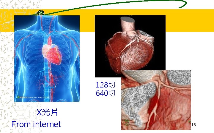 128切 640切 X光片 From internet 13 