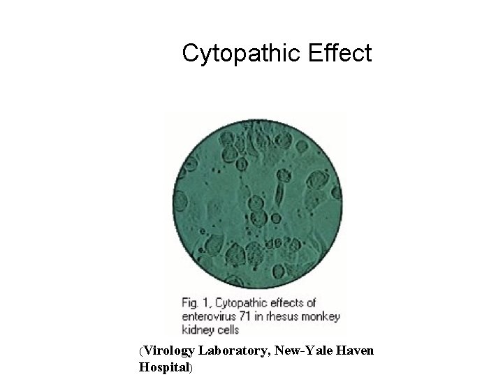 Cytopathic Effect (Virology Hospital) Laboratory, New-Yale Haven 