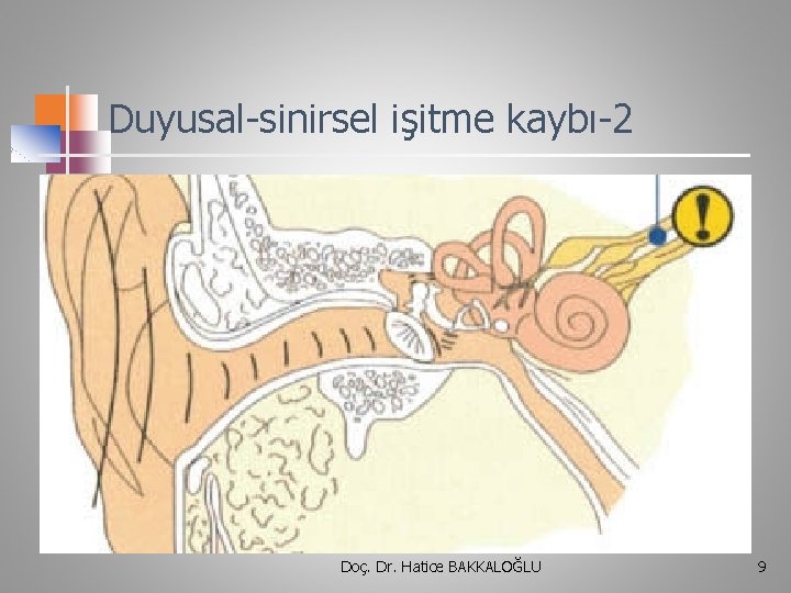 Duyusal-sinirsel işitme kaybı-2 Doç. Dr. Hatice BAKKALOĞLU 9 