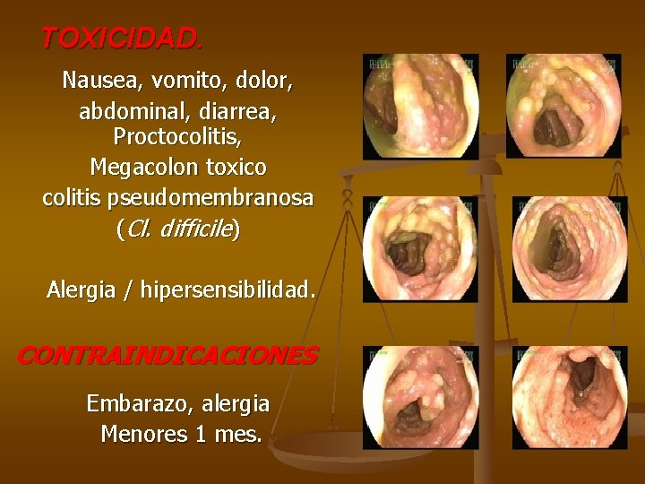 TOXICIDAD. Nausea, vomito, dolor, abdominal, diarrea, Proctocolitis, Megacolon toxico colitis pseudomembranosa (Cl. difficile) Alergia