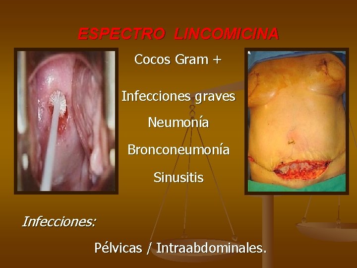 ESPECTRO LINCOMICINA Cocos Gram + Infecciones graves Neumonía Bronconeumonía Sinusitis Infecciones: Pélvicas / Intraabdominales.