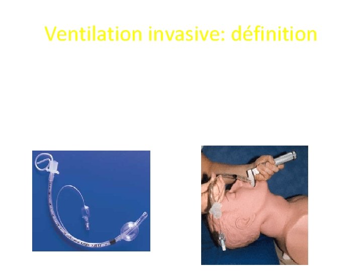 Ventilation invasive: définition • Technique de prise en charge complète ou partielle de la