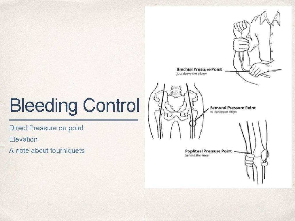 Bleeding Control Direct Pressure on point Elevation A note about tourniquets 