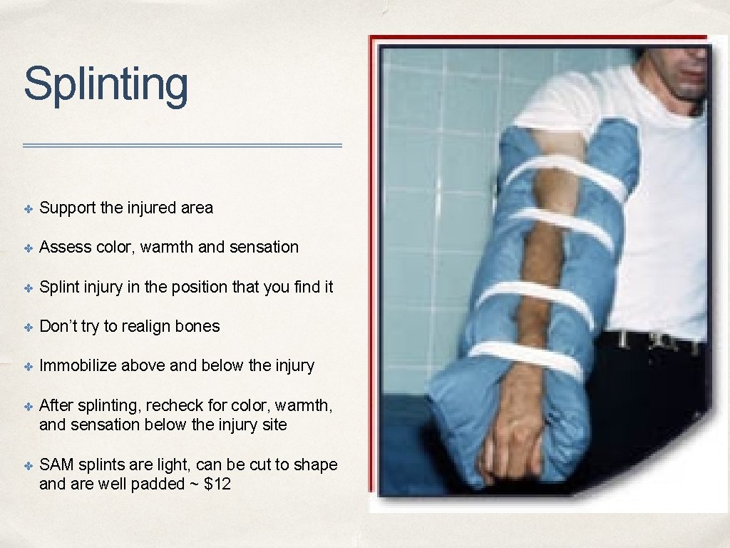 Splinting ✤ Support the injured area ✤ Assess color, warmth and sensation ✤ Splint