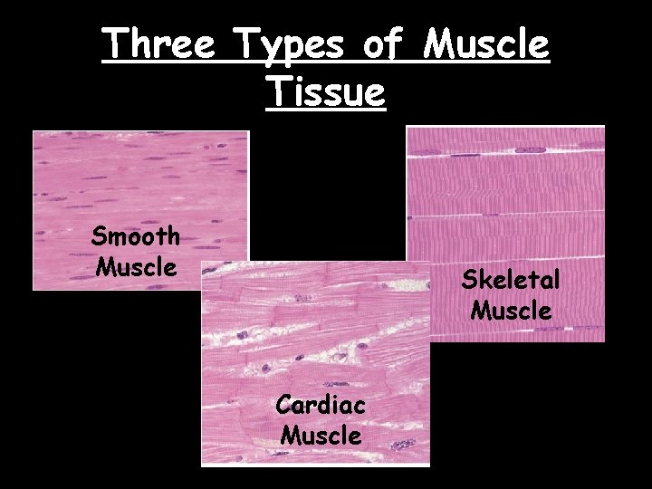 Three Types of Muscle Tissue Smooth Muscle Skeletal Muscle Cardiac Muscle 
