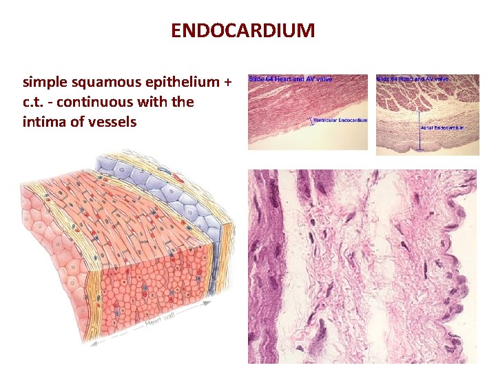 ENDOCARDIUM simple squamous epithelium + c. t. - continuous with the intima of vessels