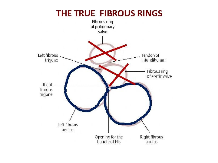 THE TRUE FIBROUS RINGS 