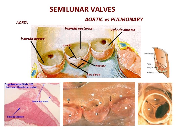 SEMILUNAR VALVES AORTIC vs PULMONARY AORTA Valvula posterior Valvula sinistra Valvula dextra Lunula Nodulus