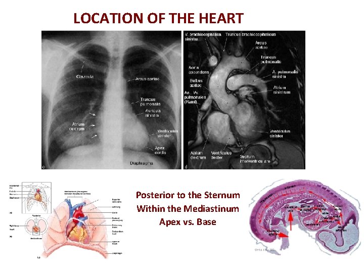 LOCATION OF THE HEART Posterior to the Sternum Within the Mediastinum Apex vs. Base