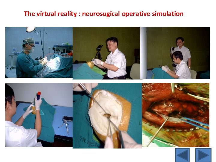 The virtual reality : neurosugical operative simulation 