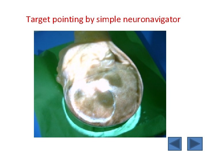 Target pointing by simple neuronavigator 