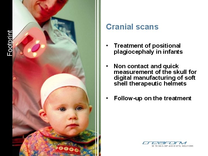 Footprint Cranial scans • Treatment of positional plagiocephaly in infants • Non contact and