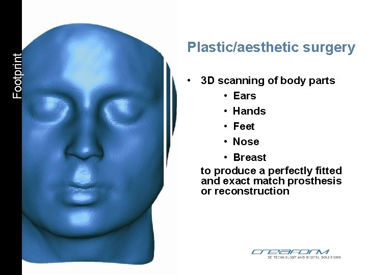 Footprint Plastic/aesthetic surgery • 3 D scanning of body parts • Ears • Hands