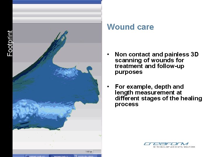 Footprint Wound care • Non contact and painless 3 D scanning of wounds for