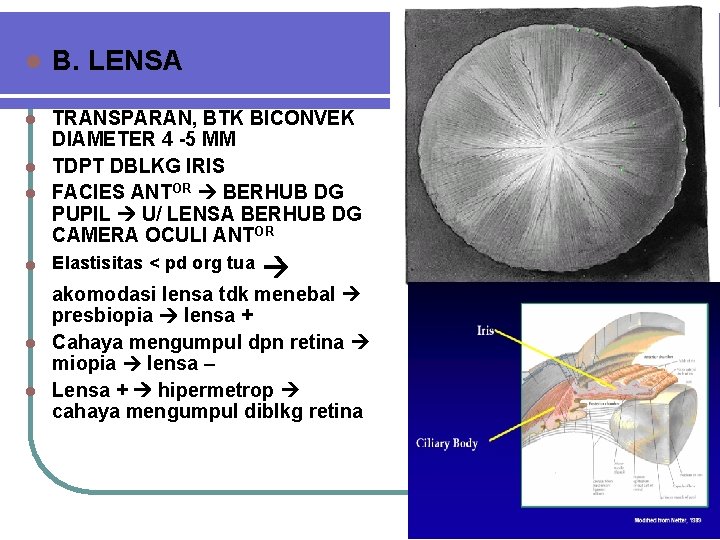 l B. LENSA TRANSPARAN, BTK BICONVEK DIAMETER 4 -5 MM l TDPT DBLKG IRIS