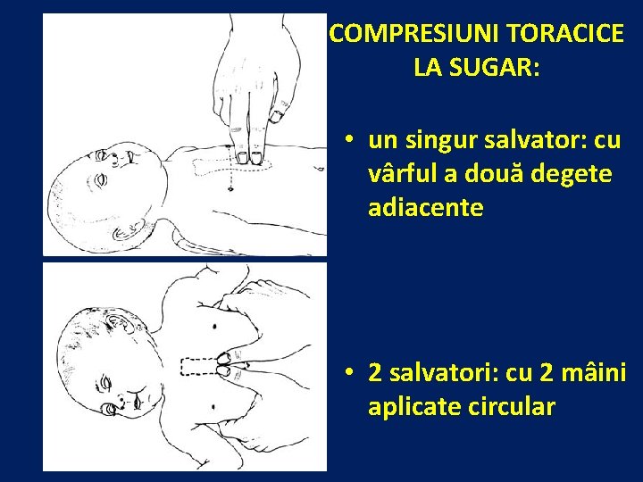 COMPRESIUNI TORACICE LA SUGAR: • un singur salvator: cu vârful a două degete adiacente