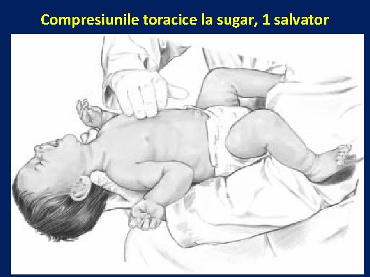 Compresiunile toracice la sugar, 1 salvator 