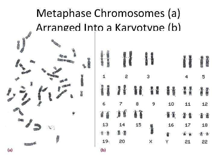 Metaphase Chromosomes (a) Arranged Into a Karyotype (b) 