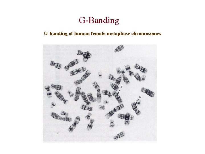 G Banding G-banding of human female metaphase chromosomes 
