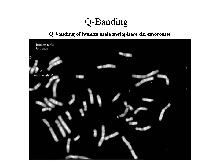 Q Banding Q-banding of human male metaphase chromosomes 