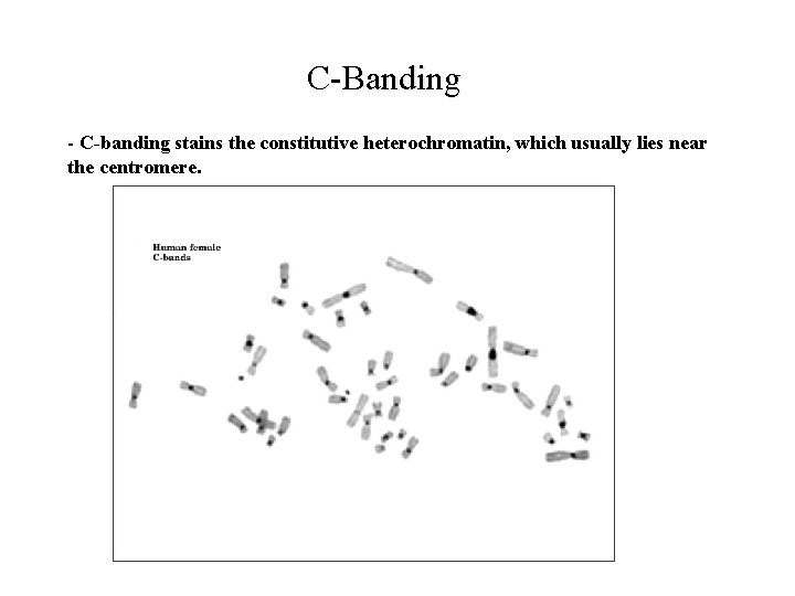 C Banding C-banding stains the constitutive heterochromatin, which usually lies near the centromere. 