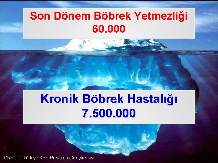 Son Dönem Böbrek Yetmezliği 60. 000 Kronik Böbrek Hastalığı 7. 500. 000 CREDIT: Türkiye