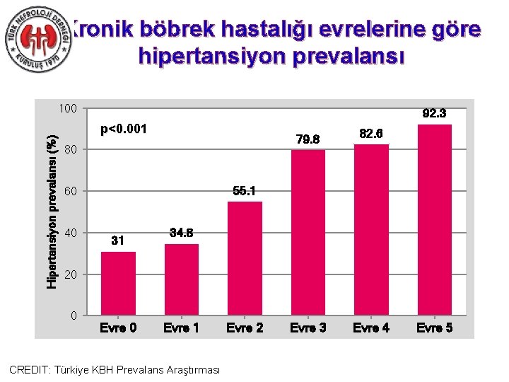 Kronik böbrek hastalığı evrelerine göre hipertansiyon prevalansı Hipertansiyon prevalansı (%) 100 92. 3 p<0.