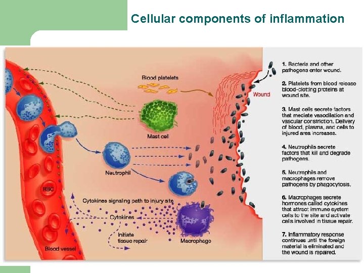 Cellular components of inflammation Cellular components of inflammation