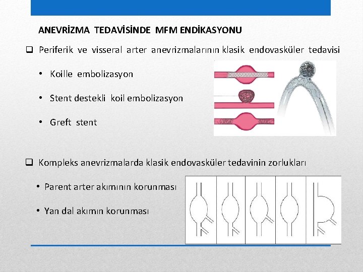 ANEVRİZMA TEDAVİSİNDE MFM ENDİKASYONU q Periferik ve visseral arter anevrizmalarının klasik endovasküler tedavisi •